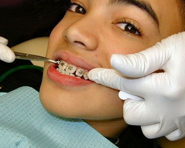 Kids Brevard County: Orthodontists - Fun 4 Space Coast Kids